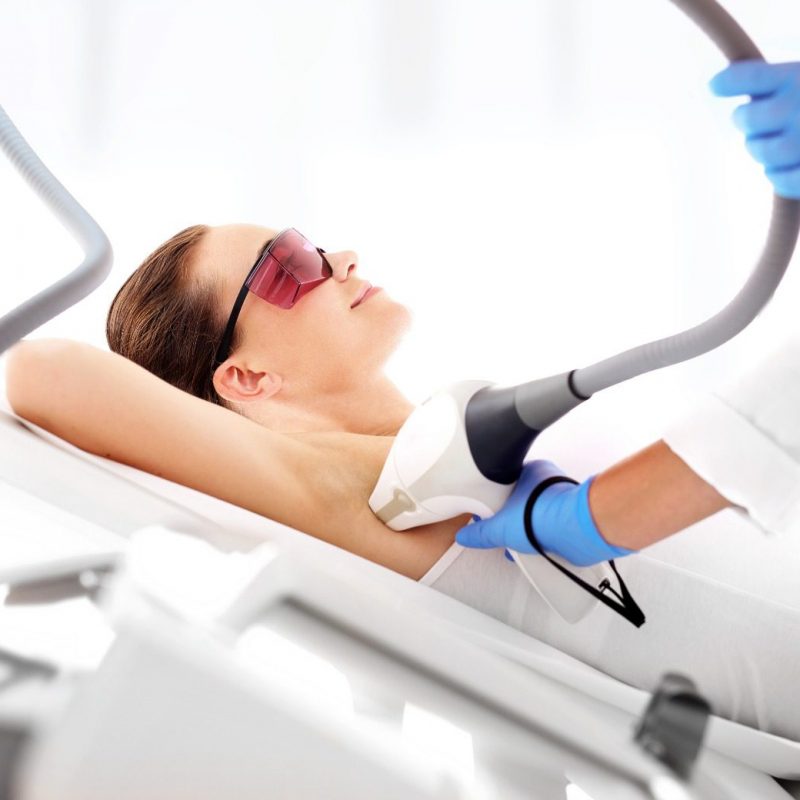 A woman getting laser hair removal done.